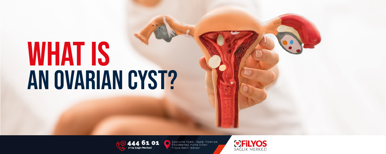 What Is An Ovarian Cyst Filyos Sağlık Merkezi